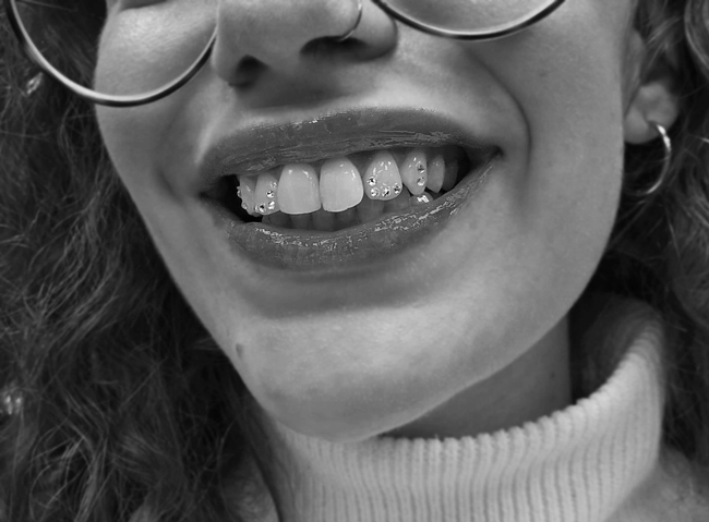 Foto eines Gesichtsausschnitts einer Person mit Toothgems auf den Zähnen